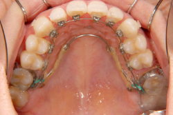 ΢¦�������־�