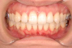 ΢¦������������