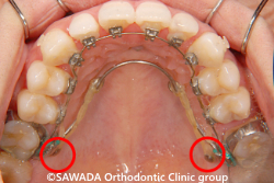 ���󥫡�������塼�ȸ����ˤ����������֤�ʻ��