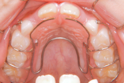 ��곰�����������־�