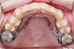 ���꼰��󥬥륢������