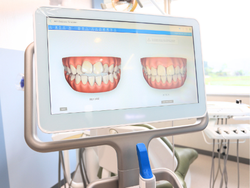 ������ʰ屡