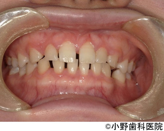 治療前