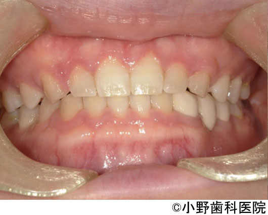 治療後