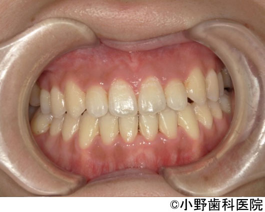 治療後