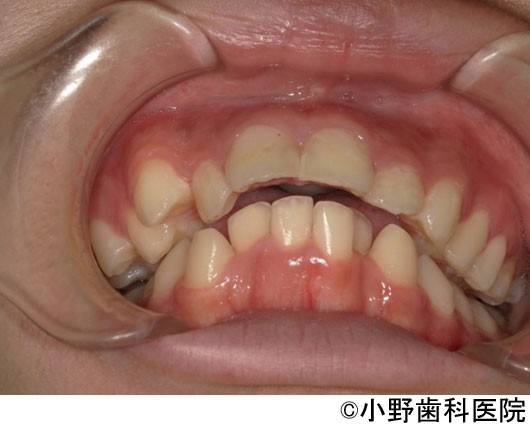 治療前