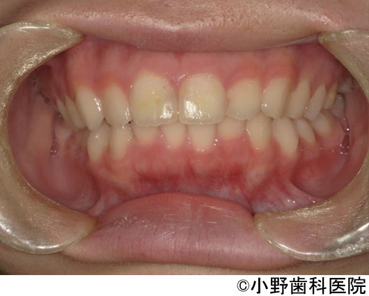 治療後