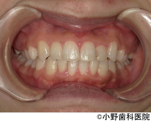 治療後