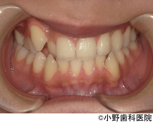 治療前