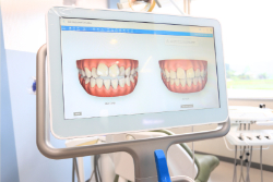 ���ŷײ������