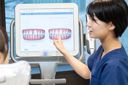 矯正治療シミュレーションを実施