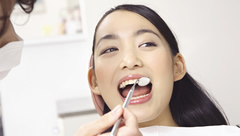 STEP9 矯正治療終了・メインテナンス開始