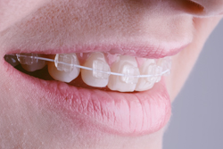 ��Ω���ˤ����磻�䡼����