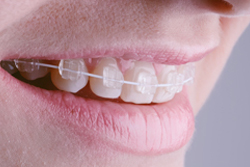 ��Ω���ˤ����磻�䡼����