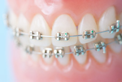 �ϥ��֥�åɶ����ˤ��б�