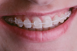 ��Ω���ˤ����磻�䡼����