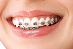 ��ʬ����