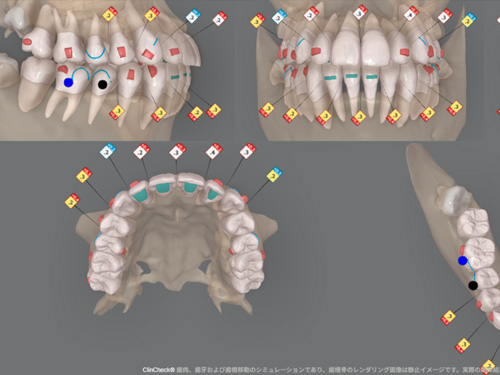 医療法人白亜会 小室歯科・矯正歯科 近鉄あべのハルカスタワー館診療所