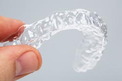 マウスピース矯正での治療