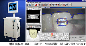 矯正歯科用CAD