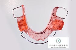 可撤式矯正装置