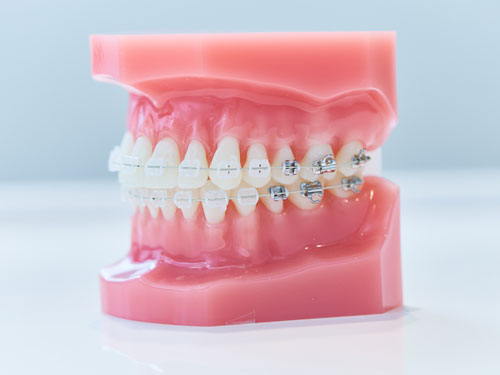 �磻�䡼����