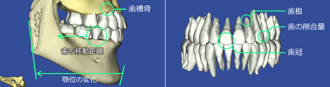 3Dシミュレーションソフトウェア