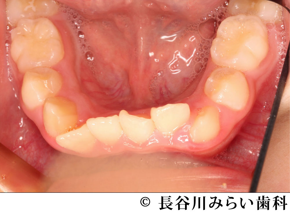 治療前