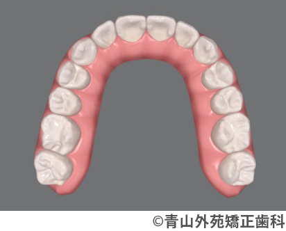 治療予測