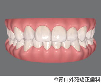 治療予測