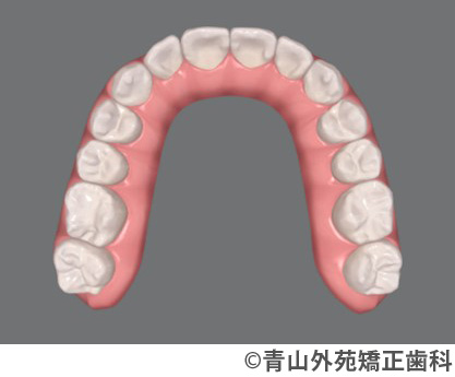 治療予測