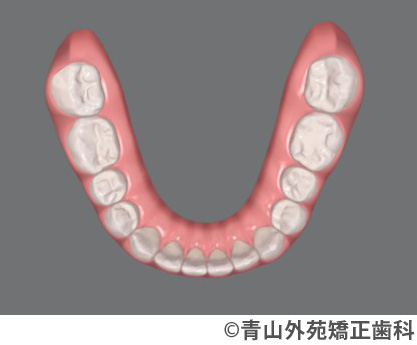 治療予測