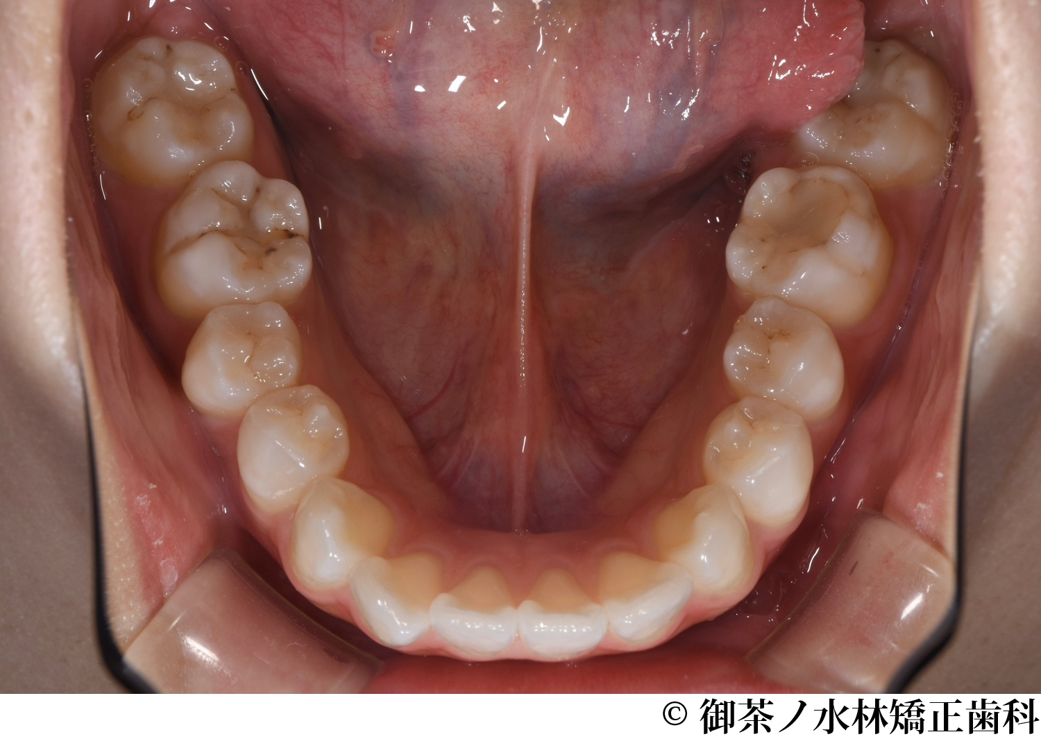 治療前