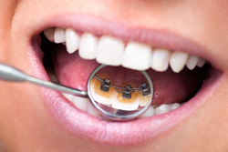 ΢¦�����Ȥ�