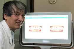 光学スキャナの活用
