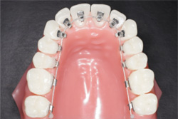 ΢¦¶ºÀµÁõÃÖ(¥ê¥ó¥¬¥ë¥Ö¥é¥±¥Ã¥È¶ºÀµÁõÃÖ)