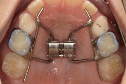 ¸ÇÄê¼°³ÈÂçÁõÃÖ(µÞ®³ÈÂçÁõÃÖ)