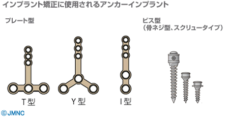 �ץ졼�ȷ��ȥӥ�������ץ���