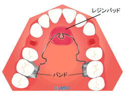 �ۡ���ǥ��󥰥�����