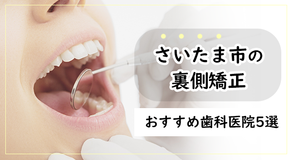 【裏側矯正に対応！】さいたま市でおすすめの矯正歯科医院5選